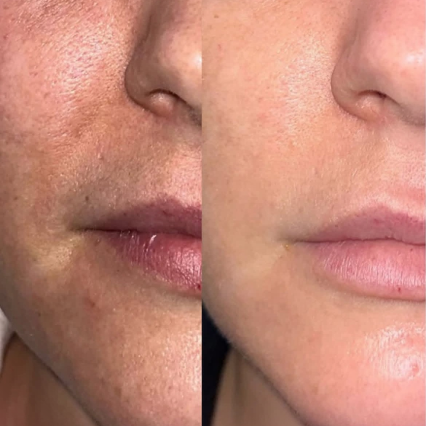 Exosomes – £200 per Session