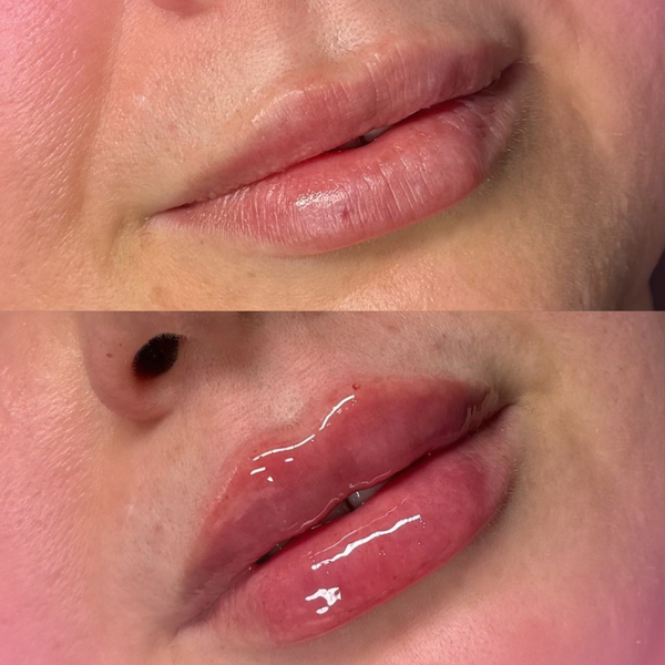 Russian Lips – £125