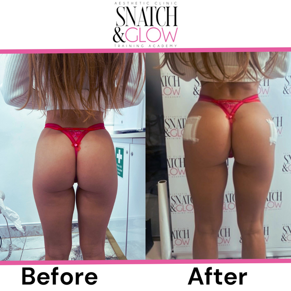 BBL – £599 per 100ml 🎃