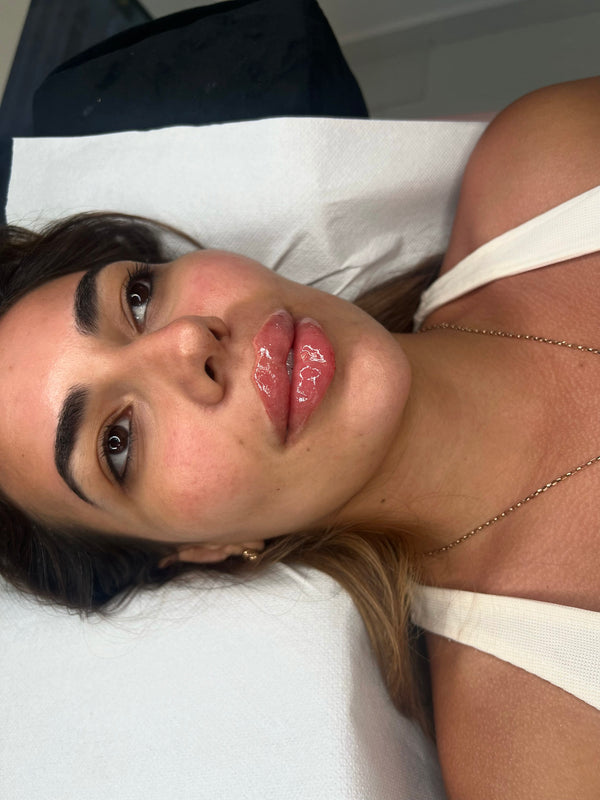 ONE TIME OFFER- £999 FOUNDATION DERMAL FILLER BEGINNER PACKAGE