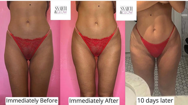 24H SALE - £1000 per 100ML -HIP & BUM FILLER PACKAGES