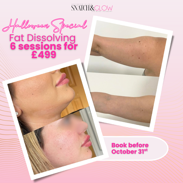 Fat Dissolve – 6 Sessions for £499