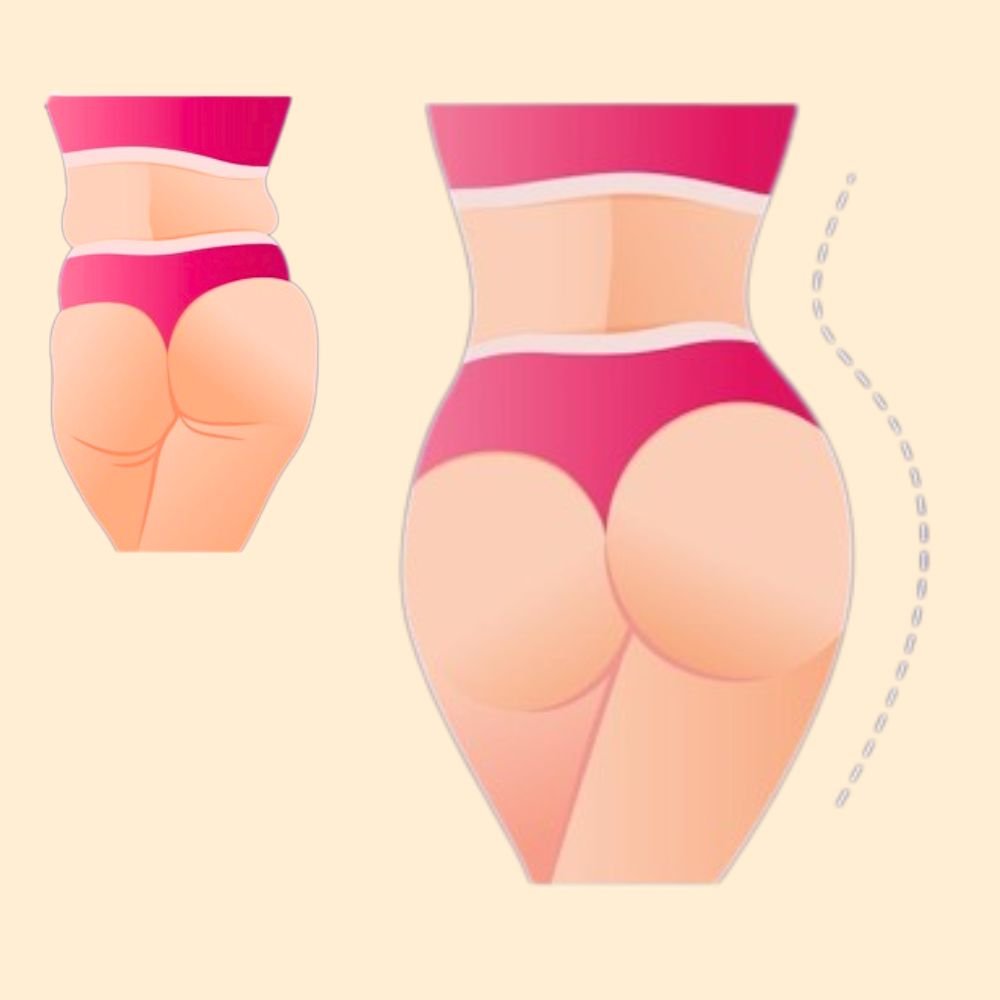 Body Filler Consultation - 30 Minutes