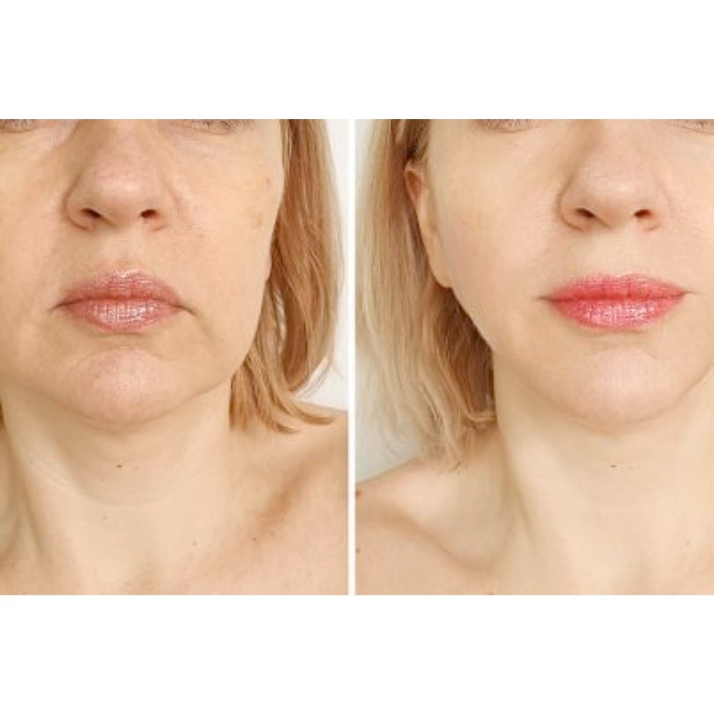Functional Thread Skin Cut Get Glowing with Threading Whole Face Treatment - Snatch and Glow London