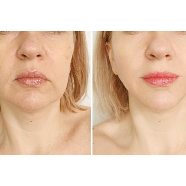 Get Glowing with Threading Whole Face Treatment - Snatch and Glow London