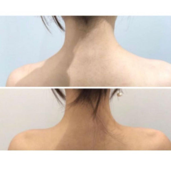 Swan Neck | Feminisation of Shoulders | Slimming Neck